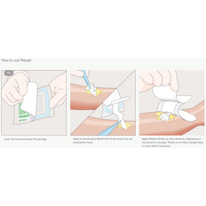 Ultrasound Probe Cover